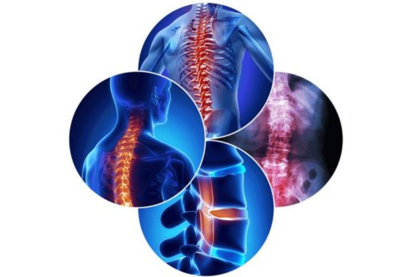 best spine surgery Hospital in Mumbai & India - MISS with world class Spine Surgeon dr. vishal kundnani