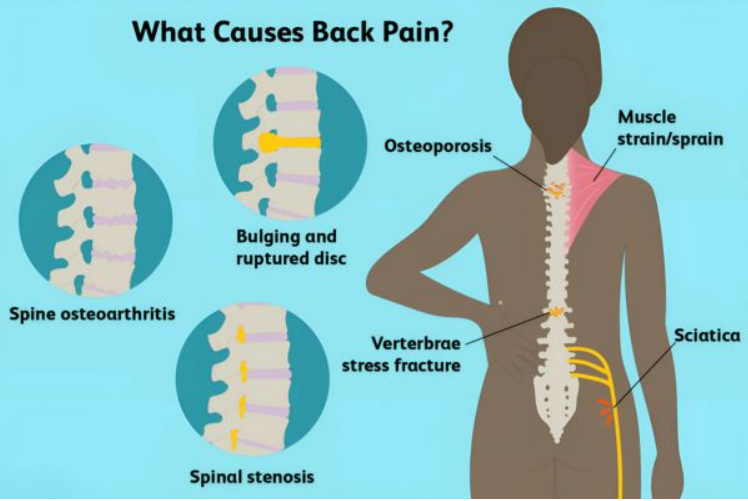 Back Pain Treatment